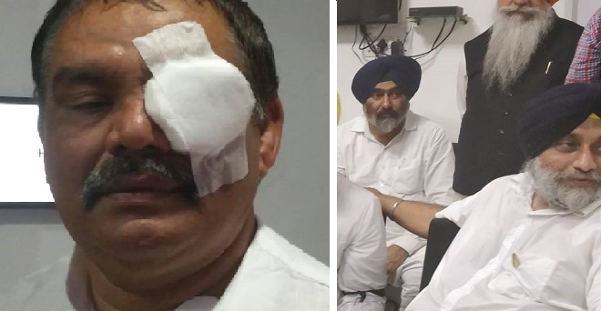 पंजाब: विधानसभा घेरने जाते हुए सुखबीर बादल गिरफ्तार, केंद्रीय मंत्री सांपला की आंख में चोट
