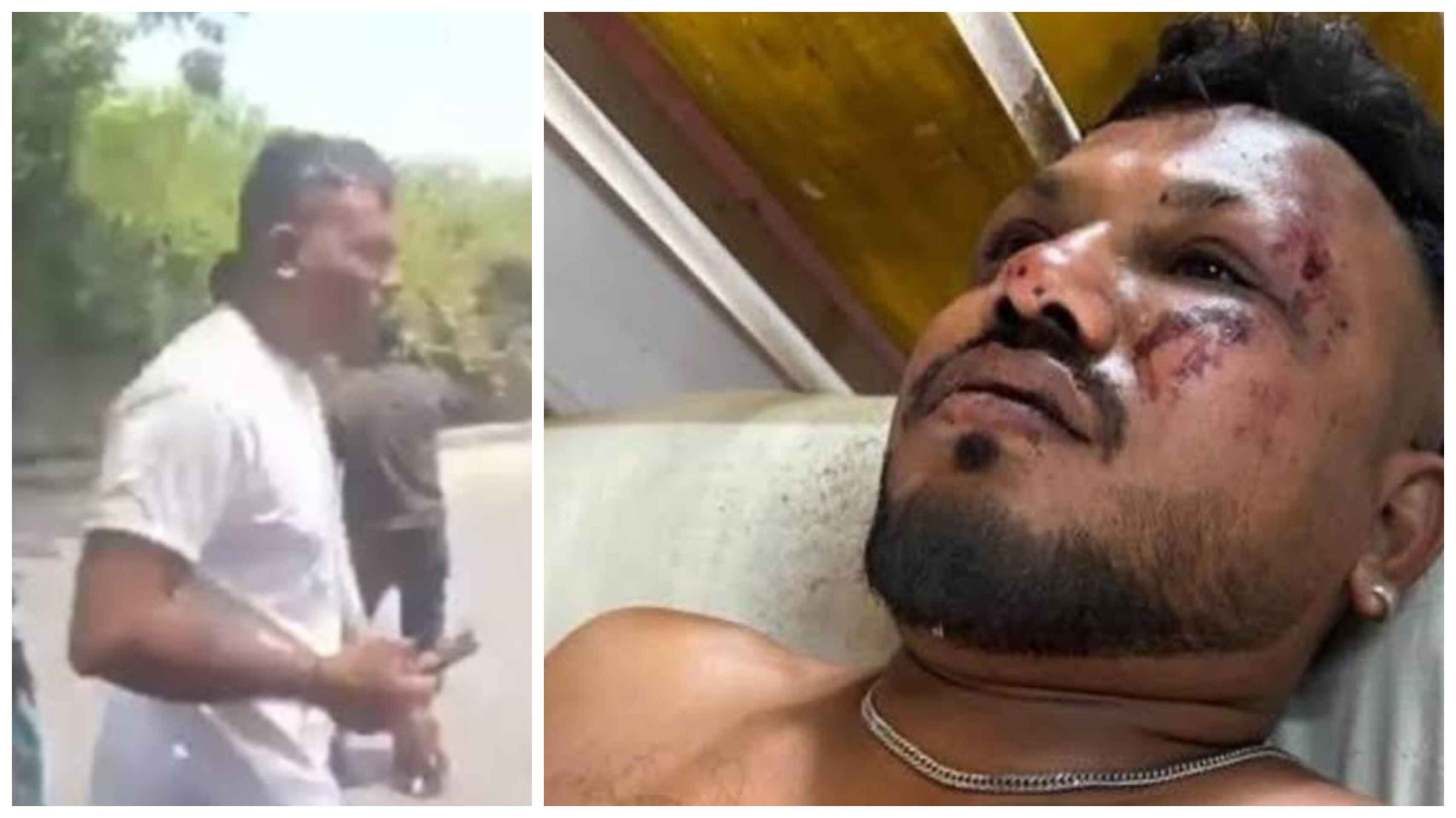 'जाको राखे साइयां मार सके न कोए', एयर इंडिया विमान दुर्घटना में जीवित बचा मिला एक व्यक्ति, डिटेल में जानें