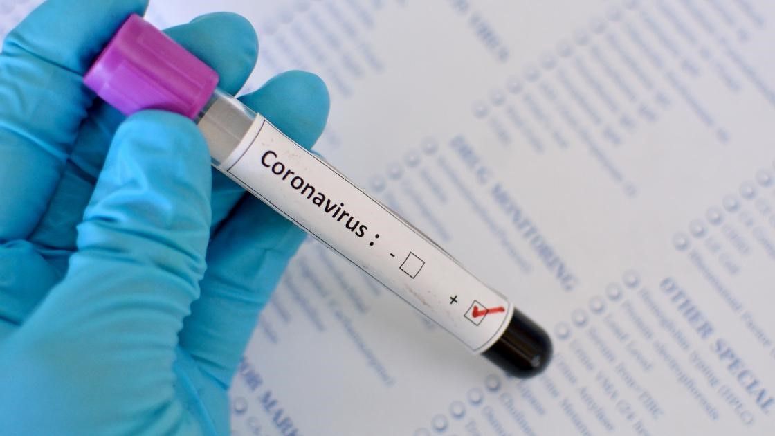 एक लाख की आबादी पर 7.9 लोग कोरोना संक्रमित, अब तक 3,303 मौत; रिकवरी रेट 39.62% हुआ