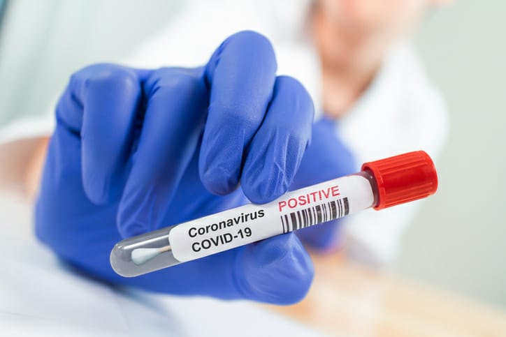 दुनिया भर में कोविड-19 महामारी के 80 लाख मरीज, चार लाख 36 हजार की मौत