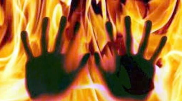 सिकंदराबाद: कथित प्रेमी ने महिला को सरेआम किया आग के हवाले, इलाज के दौरान मौत
