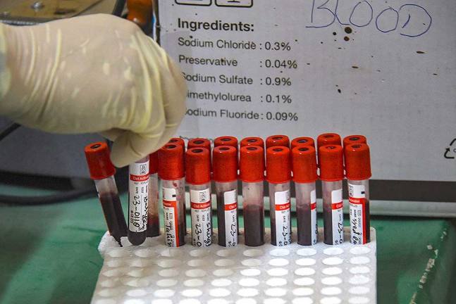 श्रीनगर के बारजुला बोन एंड ज्वाइंट हॉस्पीटल में एक डॉक्टर कोरोना वायरस का पता लगाने के लिए इम्युनोग्लोबुलिन (आइजी) ब्लड टेस्ट का सैंपल लेता हुआ।