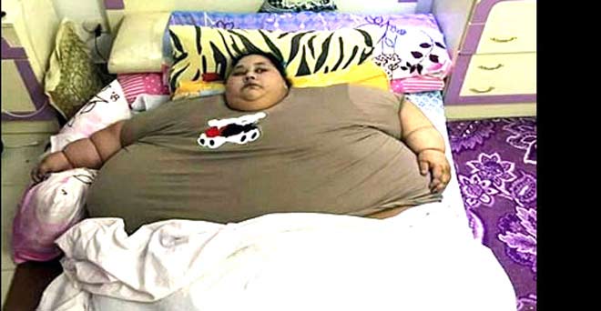 मिस्र से वजन घटाने मुंबई पहुंची 500 किलो की महिला