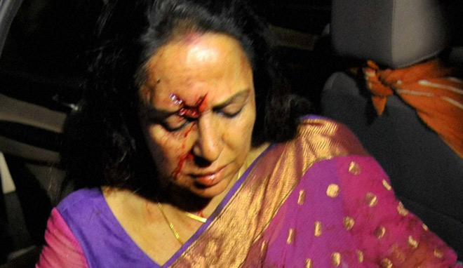 हेमा मालिनी कार दुर्घटना मामलाः पीड़ित परिवार हताश