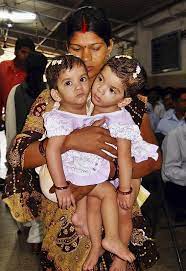 झारखंडः उम्‍मीद के विपरीत जुड़वां बेटियां हुईं तो कर दिया दान, दो परिवारों में सुनाई पड़ने लगी किलकारियां